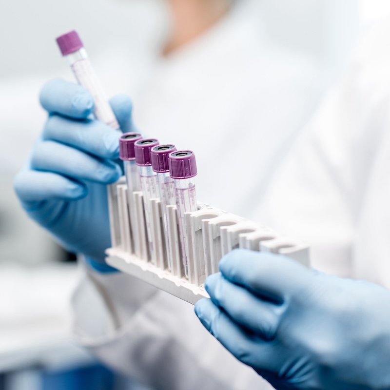 Laboratory assistant putting test tubes into the holder, Close-up view focused on the tubes
